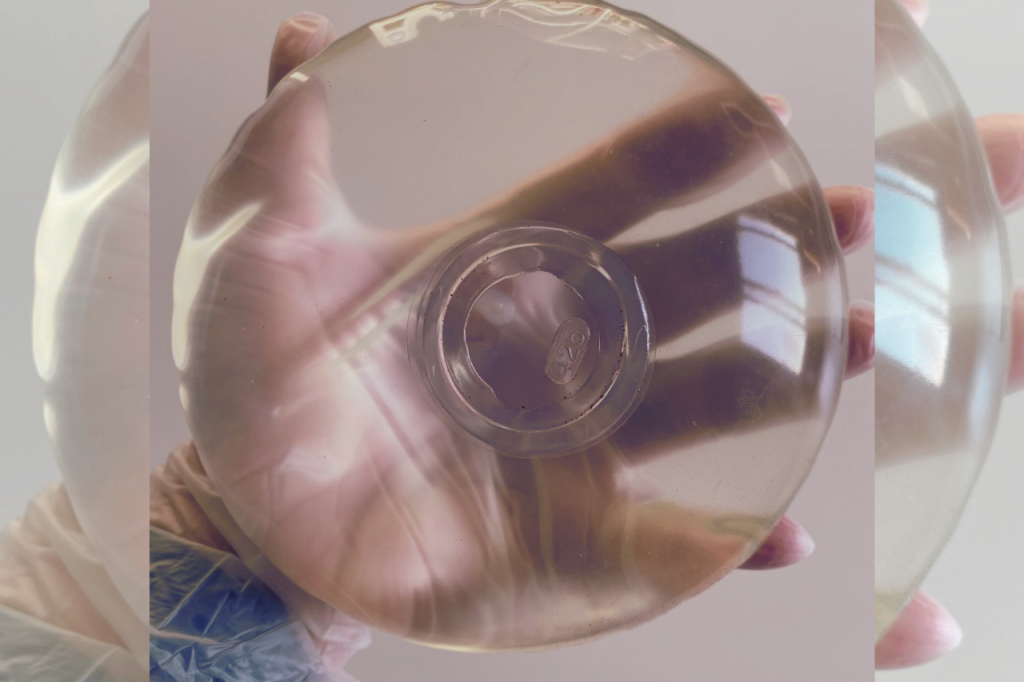 Breast Implant Illness